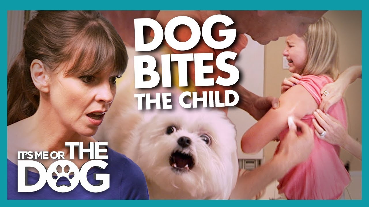 Does Dog Bite Hurt Understanding the Potential Pain and Implications