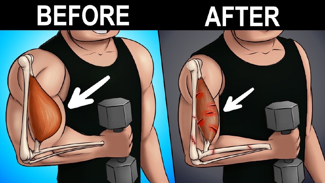 post-thumb